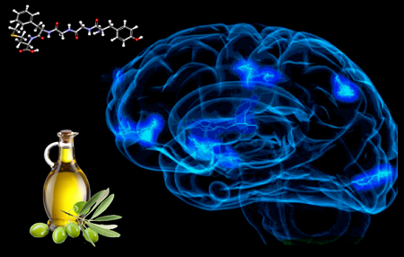 AOVE, escudo natural contra el ICTUS